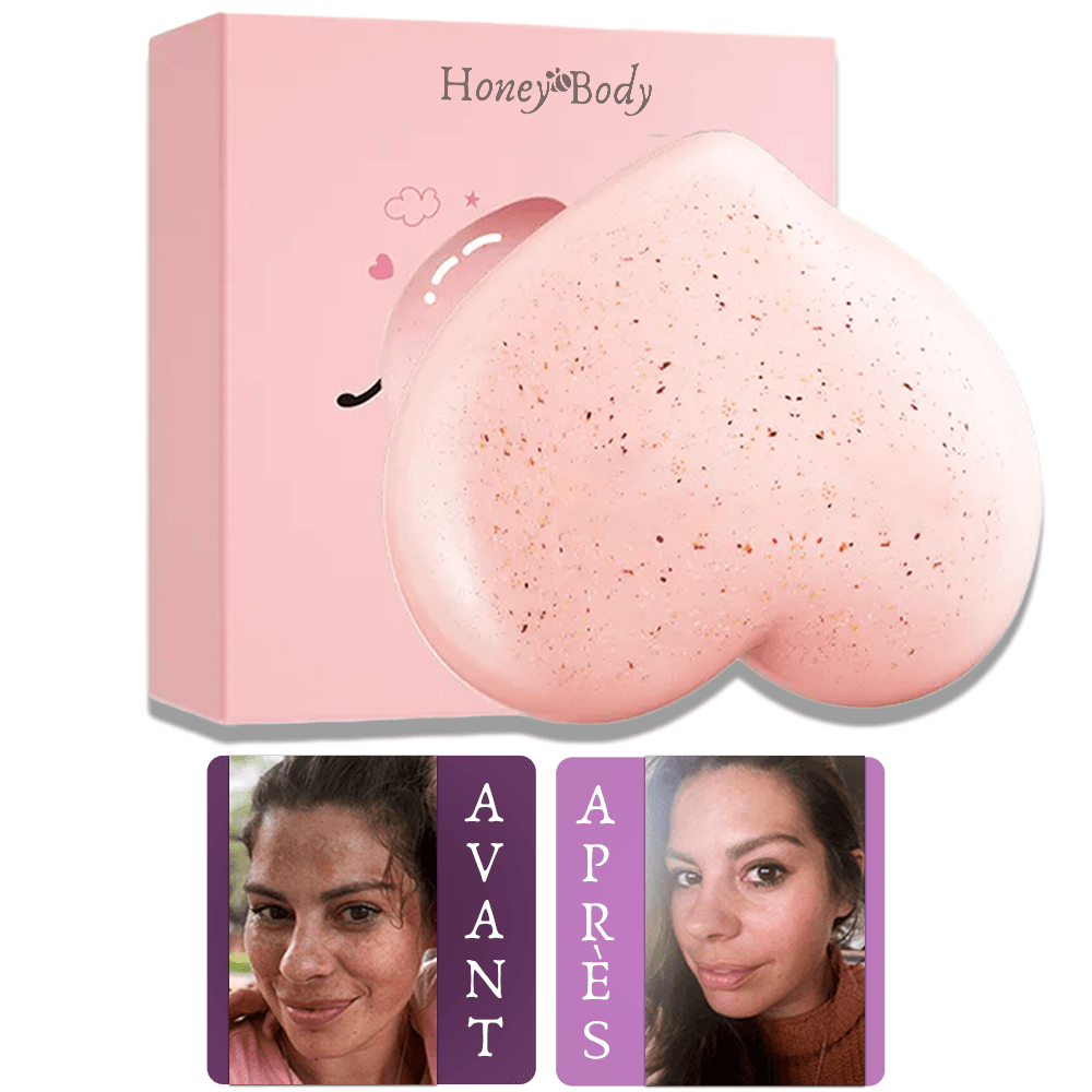 Savon antitache Soapy® : Éliminez les taches noires & impuretés de votre corps