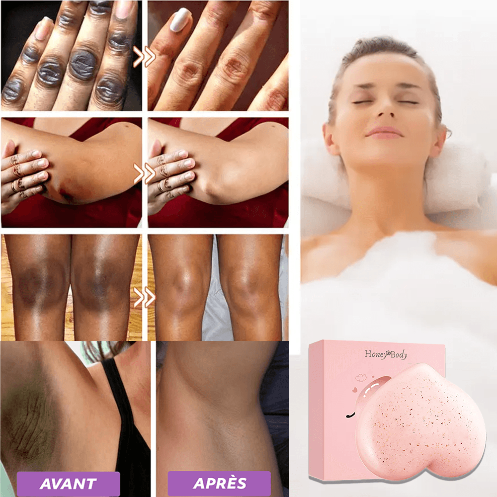 Savon antitache Soapy® : Éliminez les taches noires & impuretés de votre corps