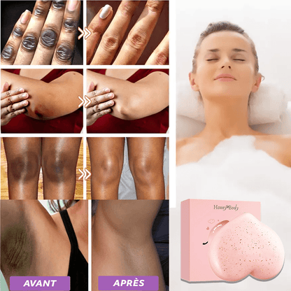 Savon antitache Soapy® : Éliminez les taches noires & impuretés de votre corps